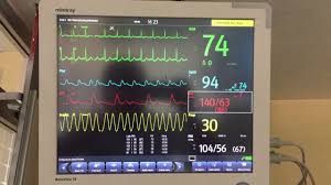 IMÁGENES ELECTROCARDIOGRÁFICAS, MONITORIZACIÓN INVASIVA Y NO INVASIVA